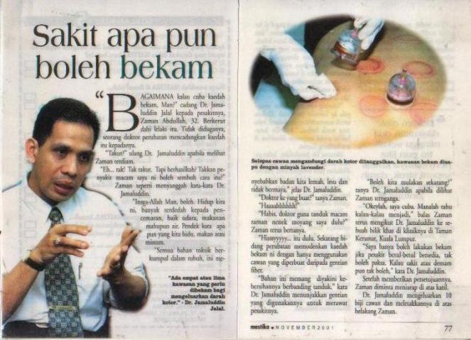 aura_bekam_1